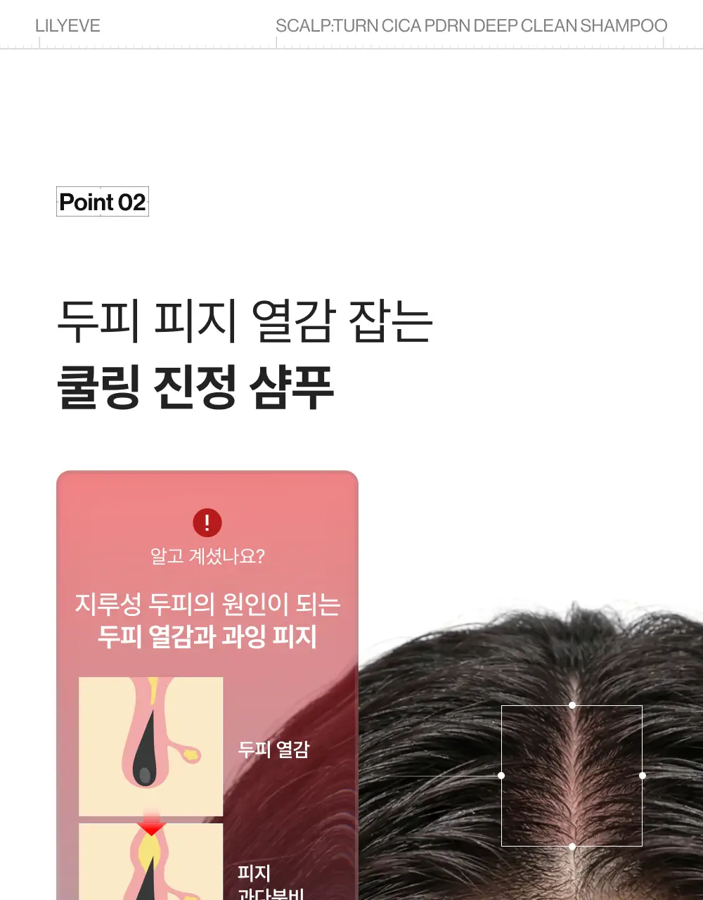 [포켓몬 에디션][비듬/각질케어]릴리이브 스칼프턴 시카 PDRN 딥클린 샴푸 500g 2종 택1 상세페이지 48